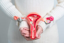 histerektomija-odstranjivanje maternice
