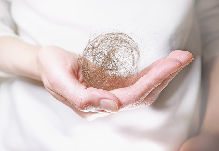 liječenje alopecije areate