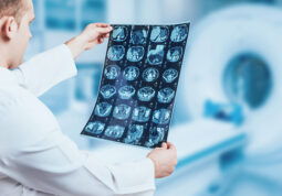 MR u otkrivanju Alzheimerove bolesti