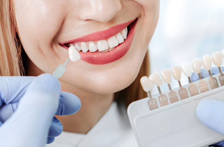 izbjeljivanje zubi-bijeli zubi