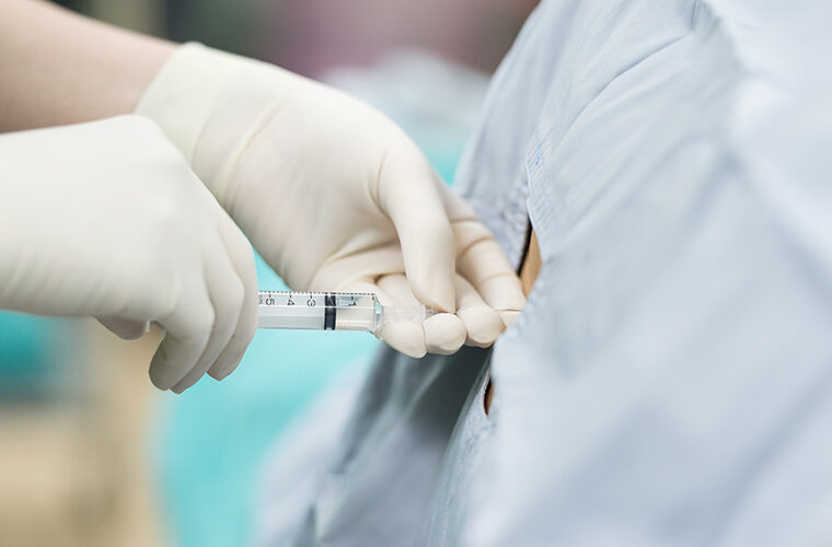 epiduralna anestezija-porod