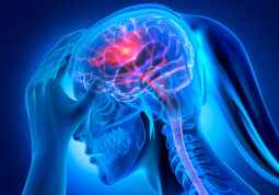 posljedice moždanog udara