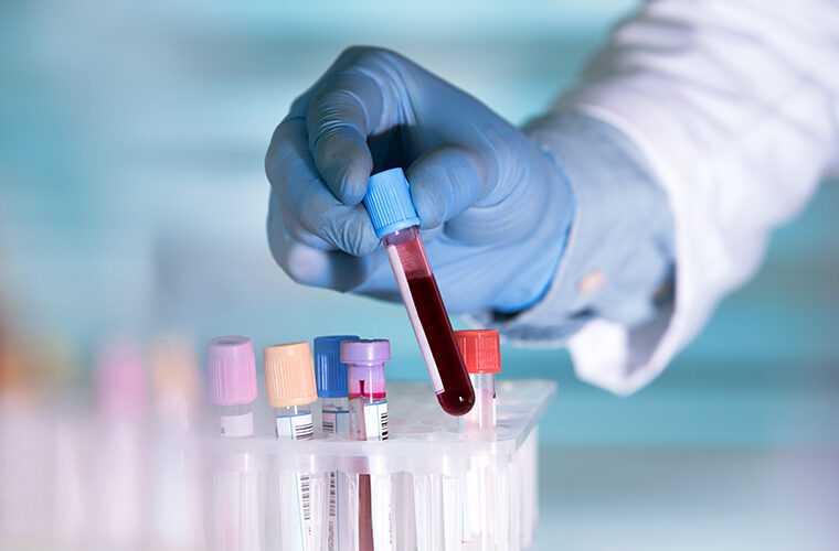 štitnjača laboratorijske pretrage