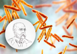 Dr. Robert Koch-tuberkuloza