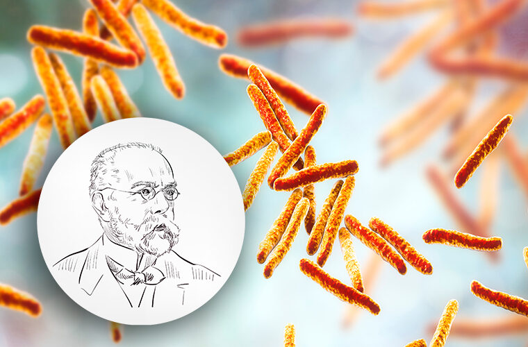 Dr. Robert Koch-tuberkuloza