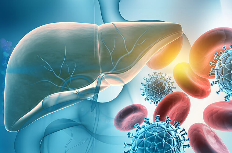 hepatitis A-žutica