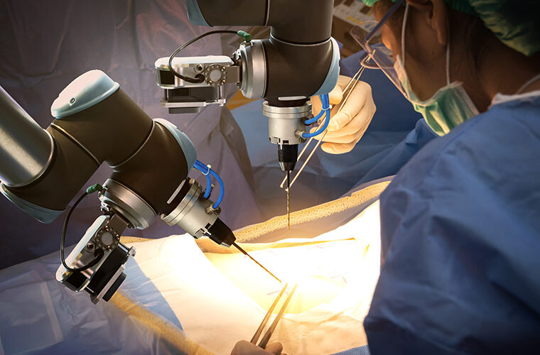 robot kirurski asistent-KBC Split