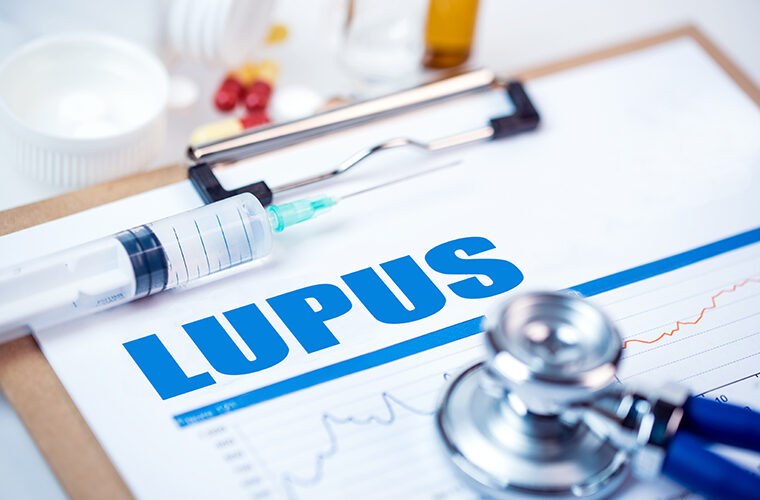lupus