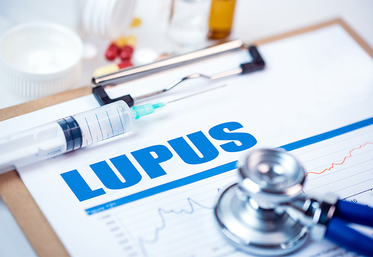 lupus