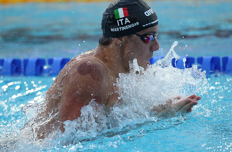 Cupping terapija sport olimpijske igre Paris