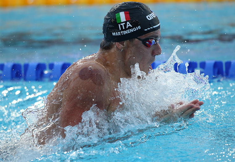 Cupping terapija sport olimpijske igre Paris