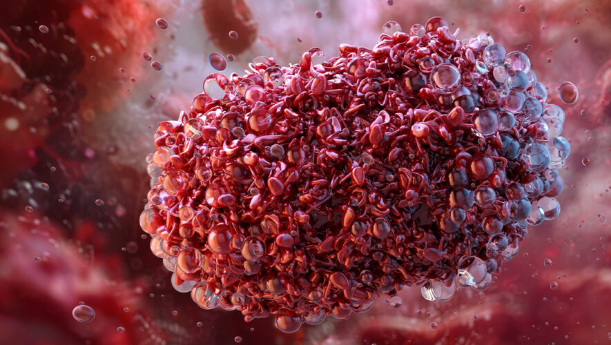 epidemija majmunske boginje mpox