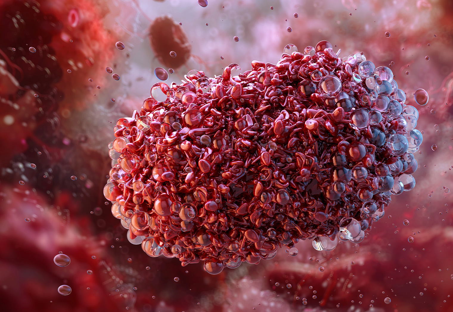 epidemija majmunske boginje mpox