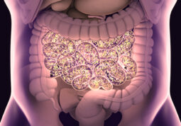 SIBO – Small Intestine Bacterial Overgrowth
