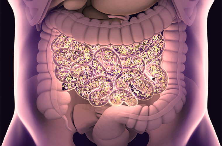 SIBO – Small Intestine Bacterial Overgrowth
