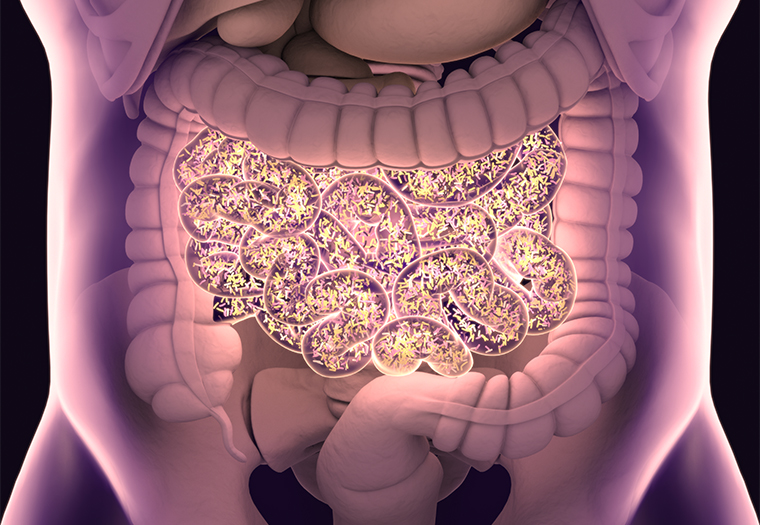 SIBO – Small Intestine Bacterial Overgrowth
