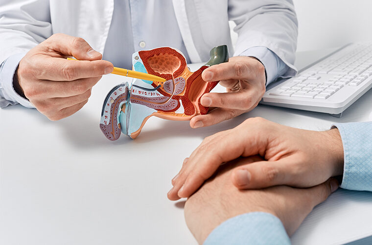benigna hiperplazija prostate
