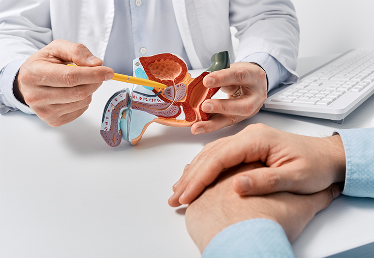 benigna hiperplazija prostate