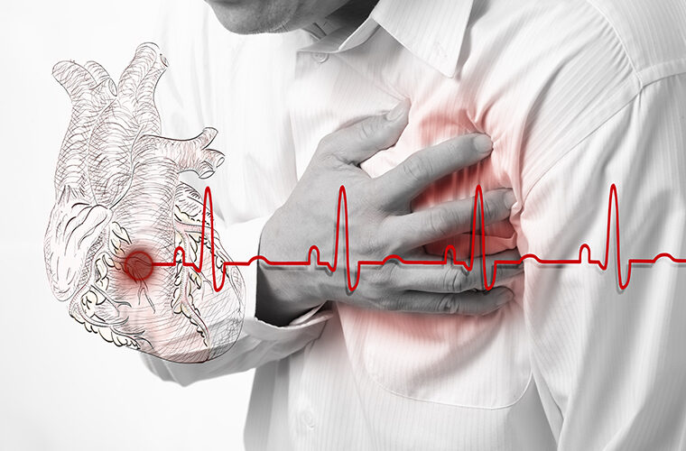 angina pektoris