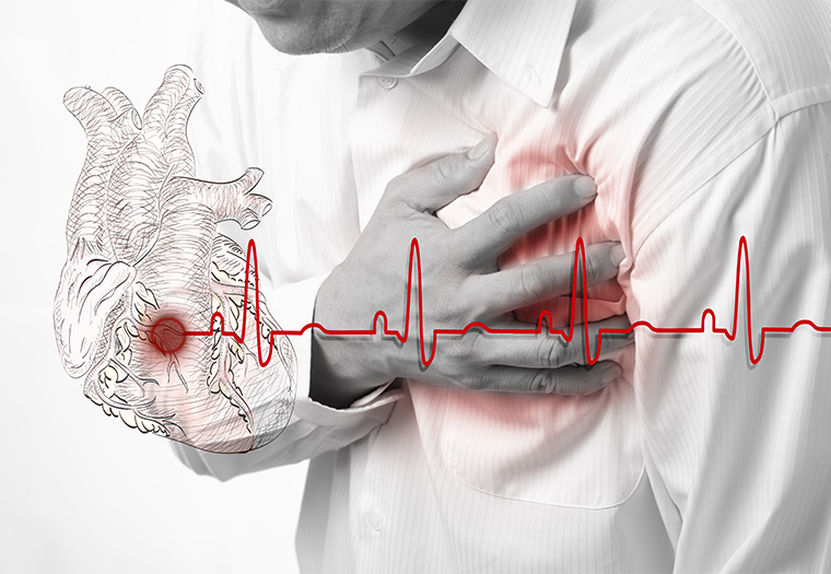 angina pektoris