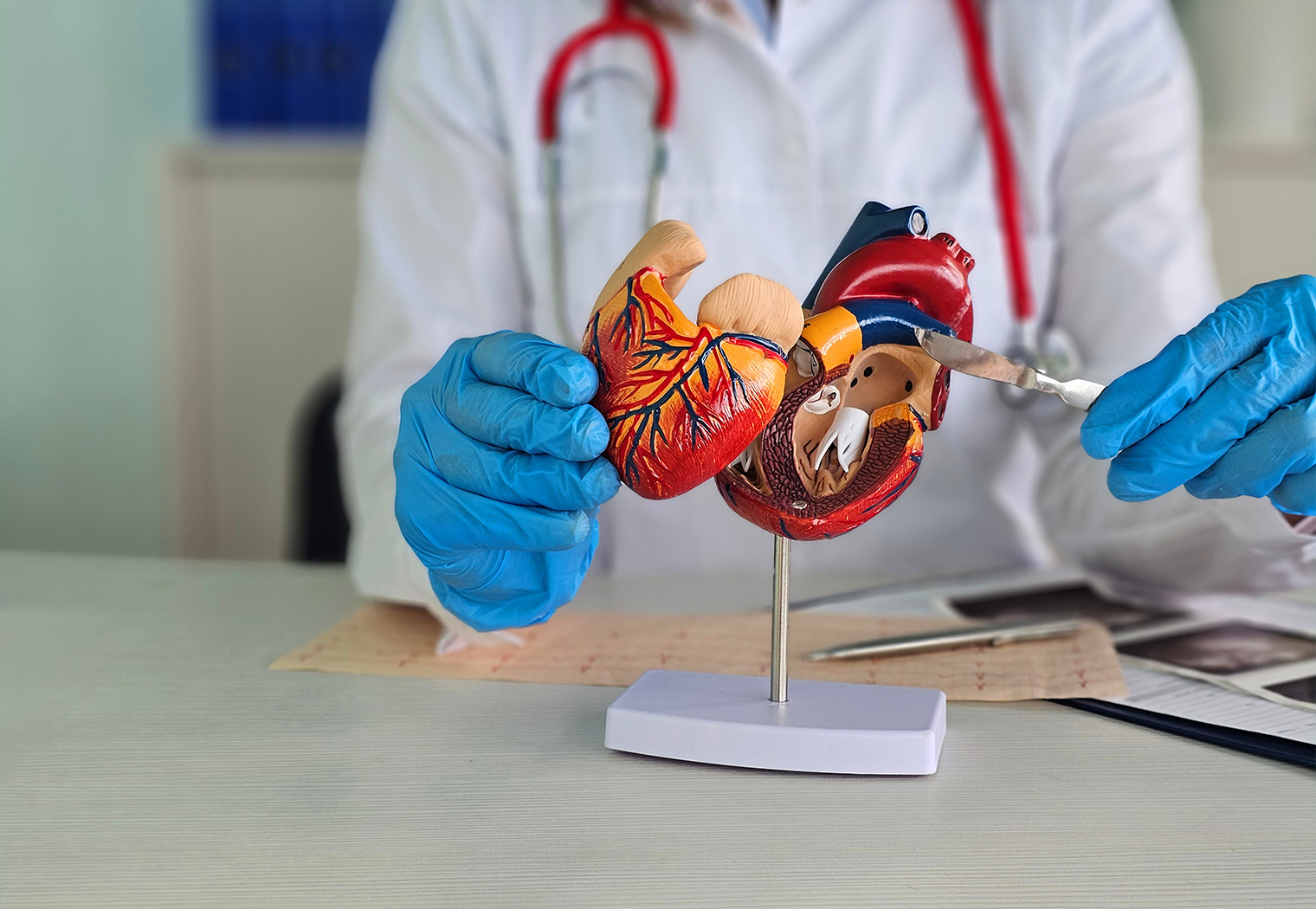 kardioloske pretrage kateterizacija srca koronarografija angiografija