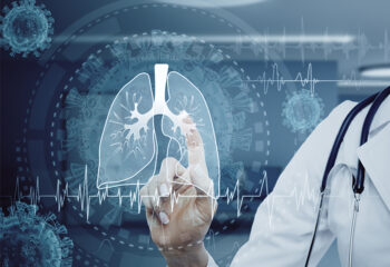 balonska angioplastika