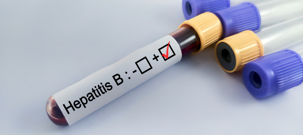 Hepatitis B